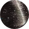 Dandruff