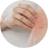 Inflammatory Skin Conditions
